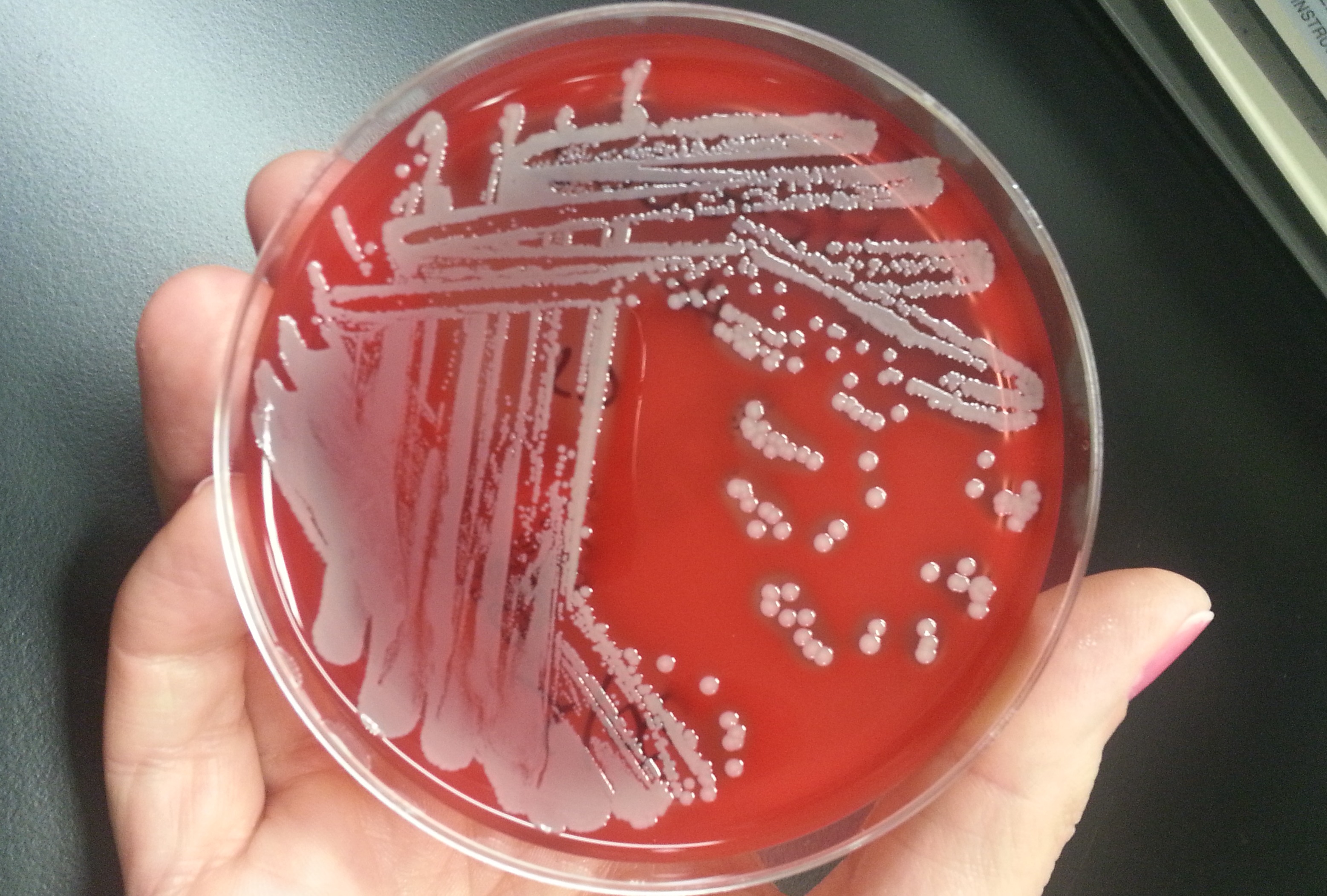 Staphylococcus Epidermidis Доксициклин – Telegraph